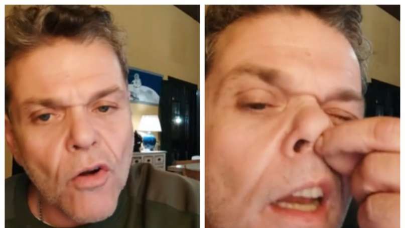 Alfredo Casero se quitó un pelo de la nariz para demostrar que no consume droga