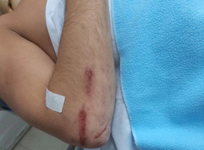 Brutal golpiza de un rugbier a un joven en un bar de Mar del Plata: "Lo siguió golpeando estando desmayado"