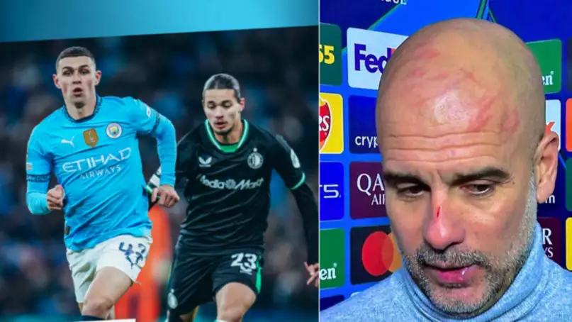 Pep Guardiola mostró las lesiones que sufrió en el rostro luego del insólito empate de Manchester City